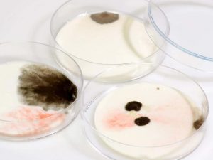 Will Dishwasher Kill Mold?